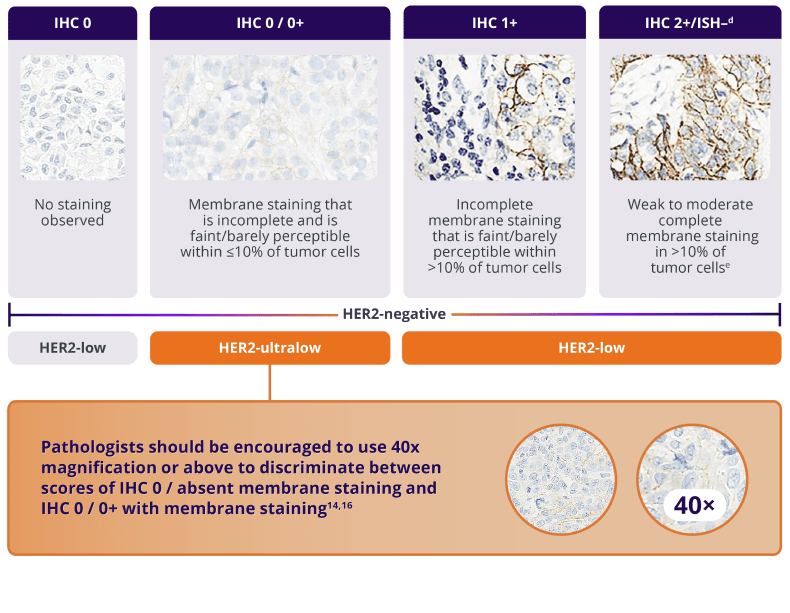 Pathologists should be encouraged to use 40 times magnification or above to discriminate between scores of IHC 0 / absent membrane staining and IHC 0 / 0+ with membrane staining
