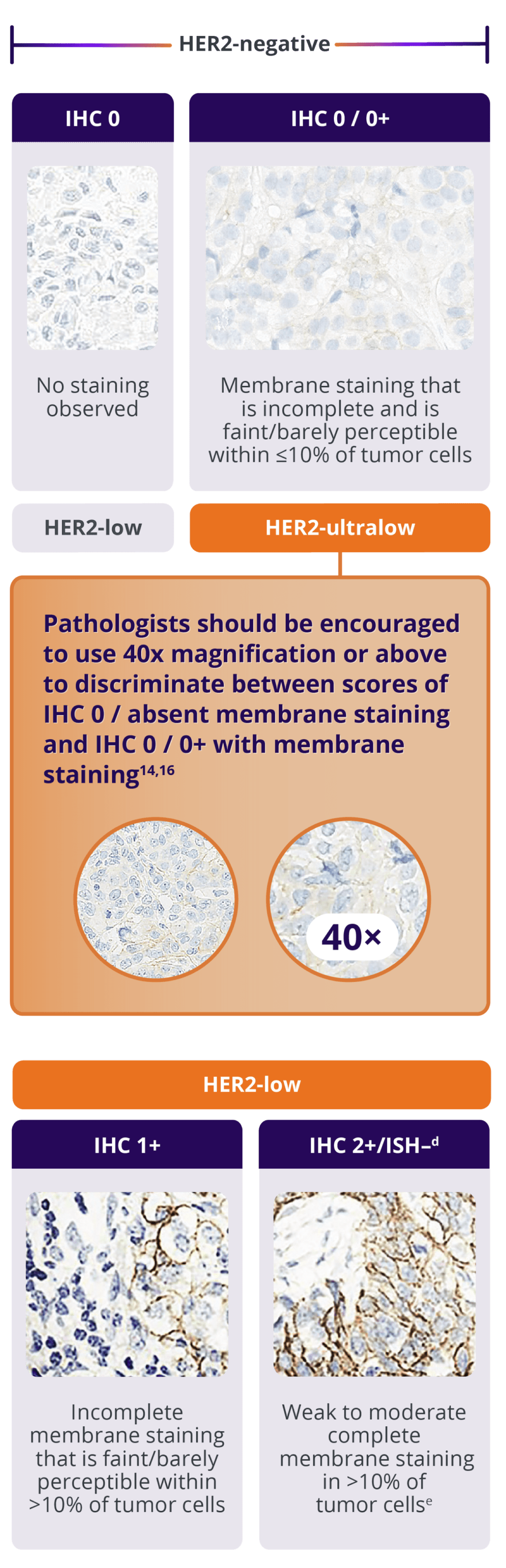 ˜Approximately 85%-90% of patients with HR+/HER2-negative mBC may have actionable levels of HER2 expression:  HER2-low (IHC 1+ or IHC 2+/ISH–) or HER2-ultralow (IHC 0 with membrane staining).