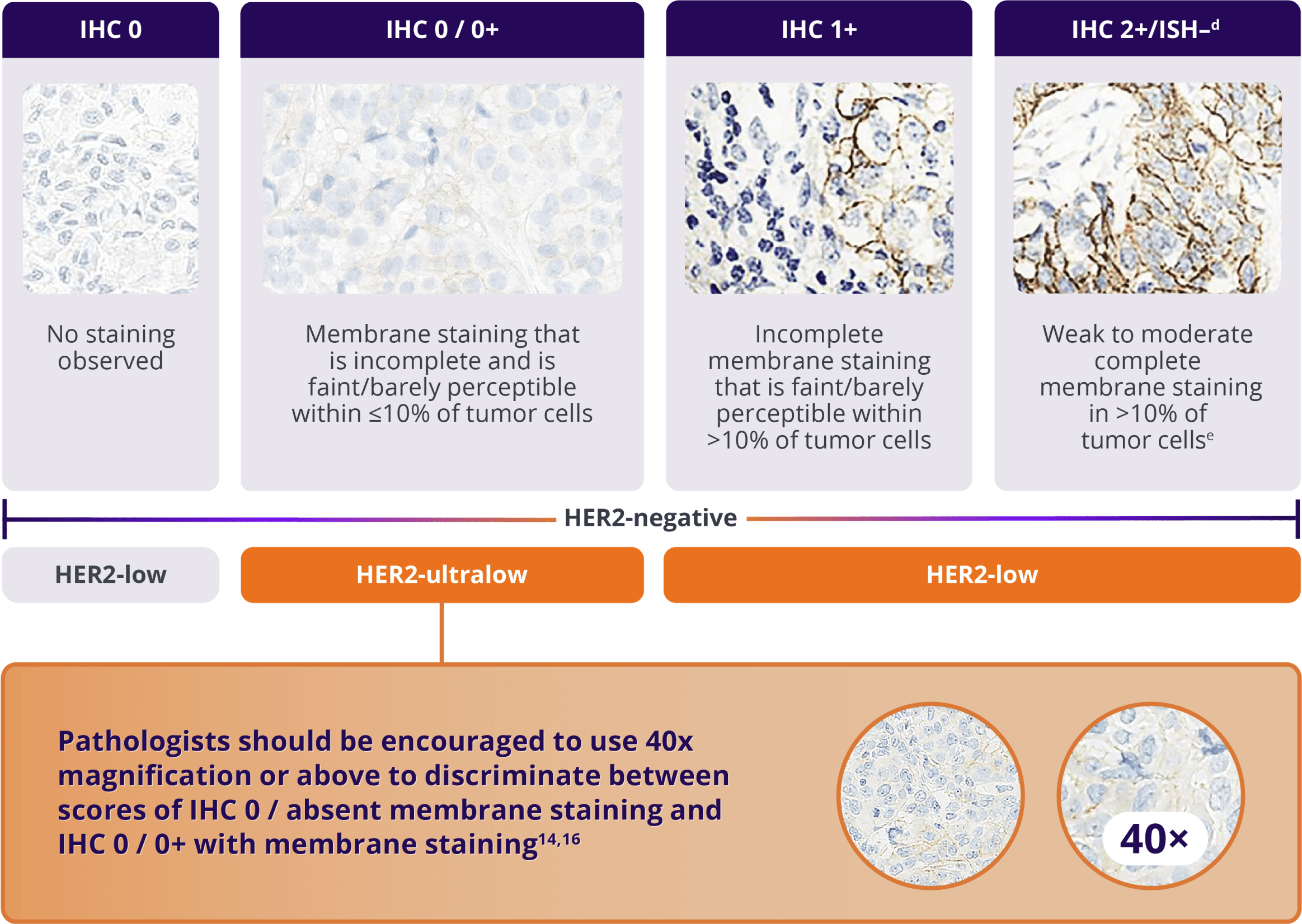 ˜Approximately 85%-90% of patients with HR+/HER2-negative mBC may have actionable levels of HER2 expression:  HER2-low (IHC 1+ or IHC 2+/ISH–) or HER2-ultralow (IHC 0 with membrane staining).